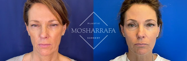 imgi_10_Mosharrafa_Gallery-Filler-full-face-230-AP