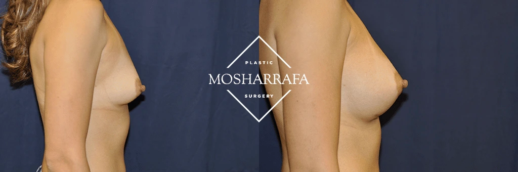 imgi_11_3867-2-merged