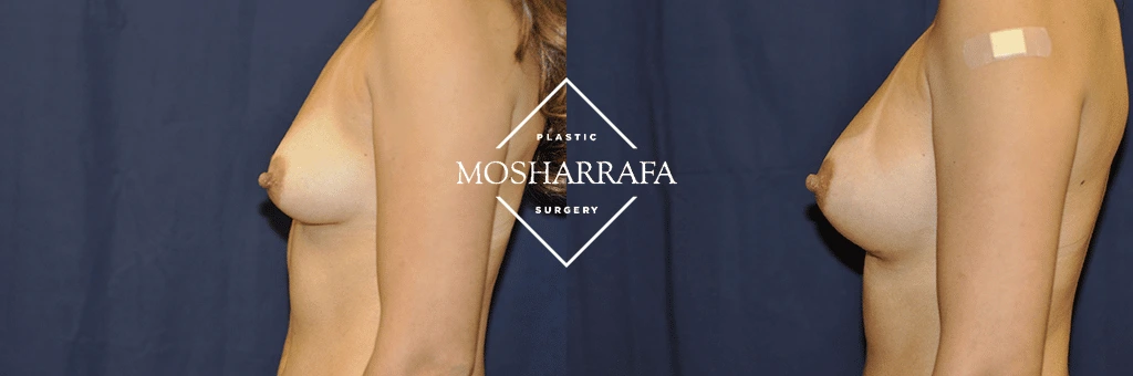 imgi_12_3867-3-merged